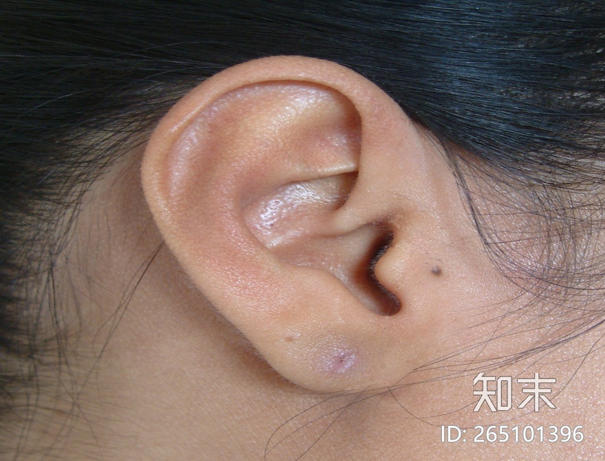 皮肤贴图下载【ID:265101396】
