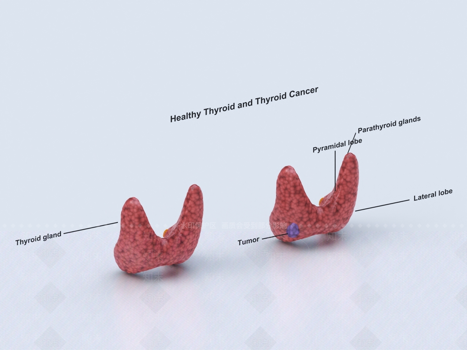 甲状腺3D模型下载【ID:1147687088】
