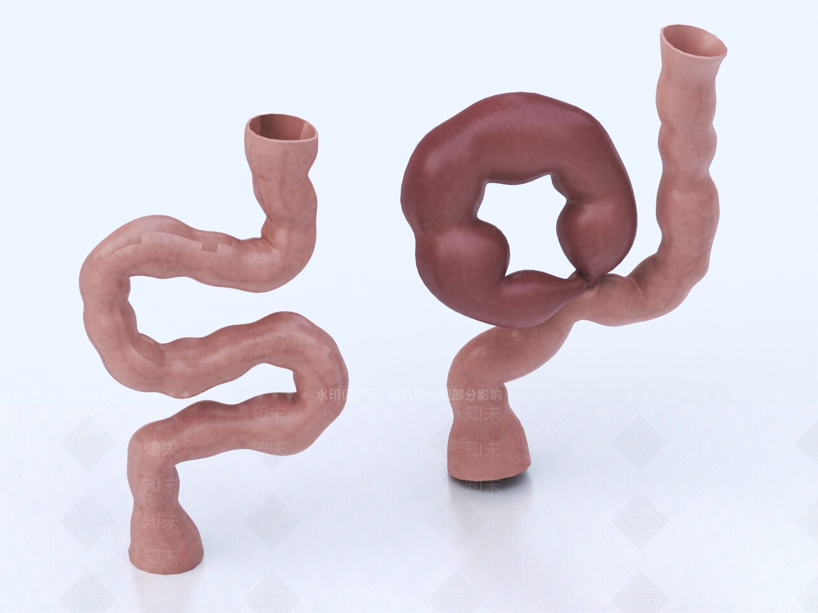 结肠扭转3D模型下载【ID:1147778446】