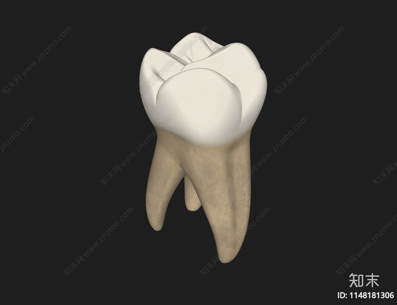 牙科假体SU模型下载【ID:1148181306】