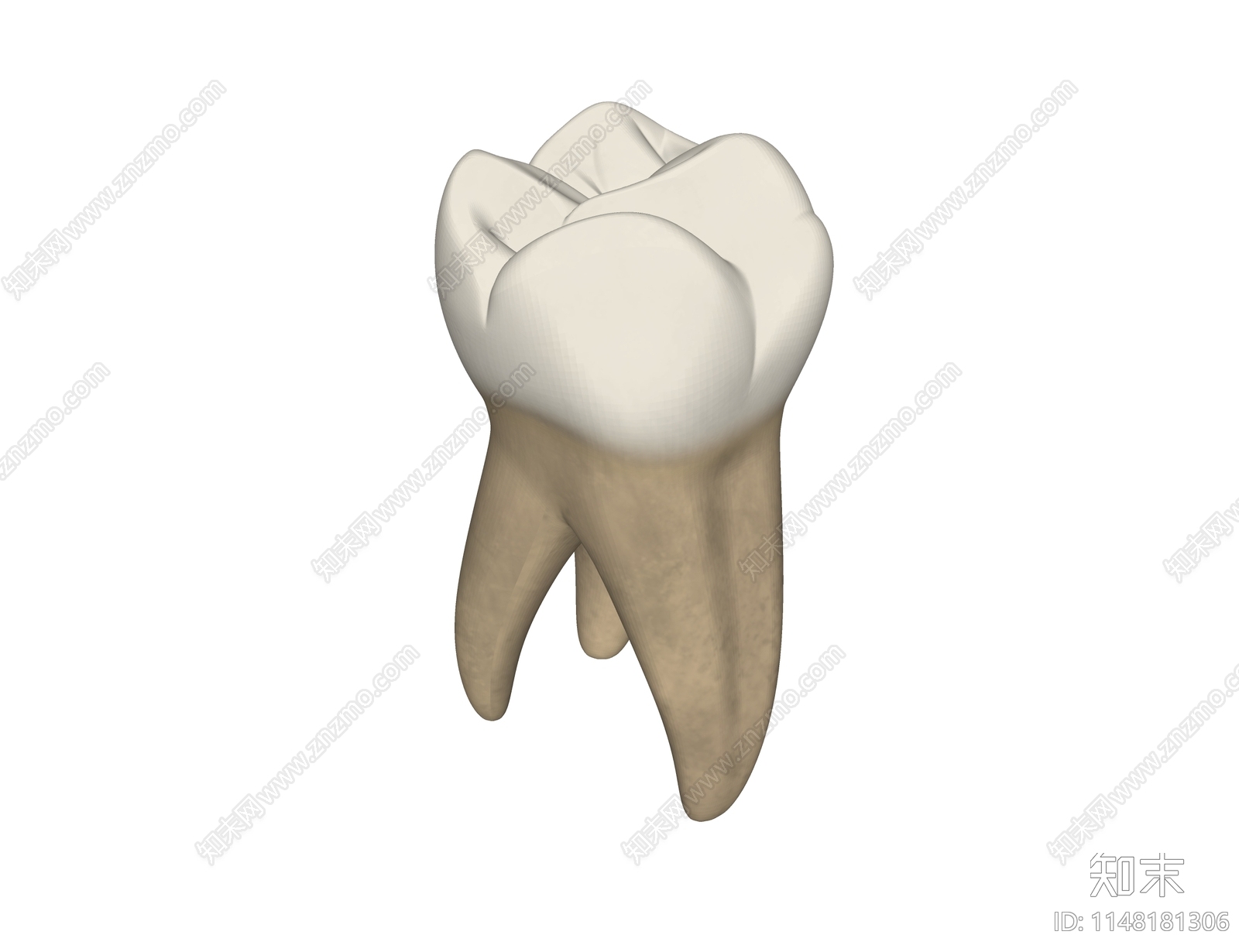 牙科假体SU模型下载【ID:1148181306】