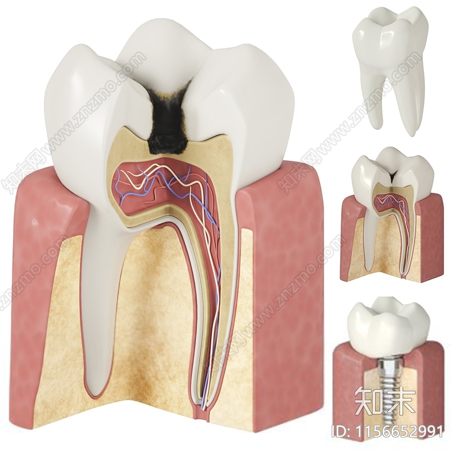 医疗器材3D模型下载【ID:1156652991】