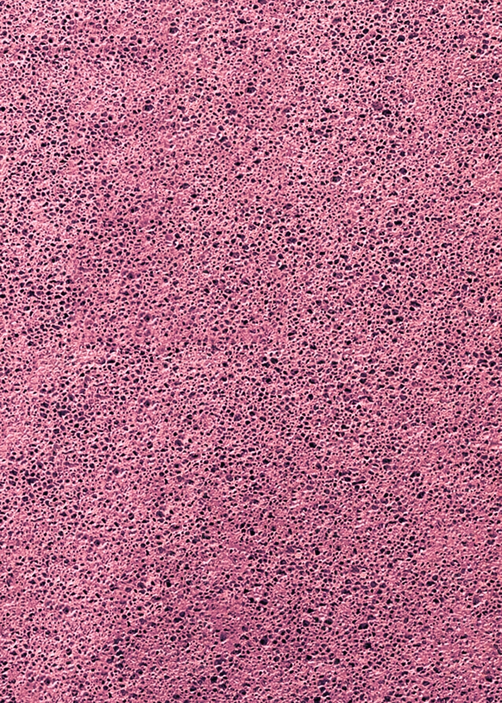 现代法式铝扣板贴图下载【ID:1172705297】